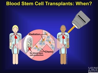 Blood Stem Cell Transplants: When?
No blood stem
cell production
Chemo
Radiation
X
 