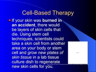 Cell-Based Therapy
If your skin was burned in
an accident, there would
be layers of skin cells that
die. Using stem cell
techniques, scientists could
take a skin cell from another
area on your body or stem
cell and grow new plates of
skin tissue in a lab tissue
culture dish to regenerate
new skin cells for you.
QuickTime™ and a
TIFF (Uncompressed) decompressor
are needed to see this picture.
http://biodidac.bio.uottawa.ca/thumbnails/filedet.htm?File_name=HUMN164B&File_type=GIF
 