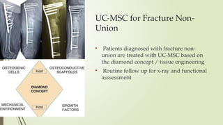 UC-MSC for Fracture Non-
Union
• Patients diagnosed with fracture non-
union are treated with UC-MSC based on
the diamond concept / tissue engineering
• Routine follow up for x-ray and functional
asssessment
 