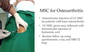 MSC for Osteoarthritis
• Intraarticular injection of UC-MSC
for patients with knee osteoarthritis
• UC-MSC given once, followed with
intraarticular injection of
hyaluronic acid
• Routine follow up using
questionnaire, x-ray, and MRI T2
map
 