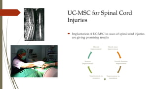 UC-MSC for Spinal Cord
Injuries
 Implantation of UC-MSC in cases of spinal cord injuries
are giving promising results
Muscle mass
improvement
Erectile function
improvement
Improvement on
ejaculation
Improvement on
sensation
Sensory
improvement?
Motoric
improvement?
 