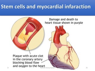 Stem cells and myocardial infaraction
04/09/2018 25Yasmine Hosny Hassan
 