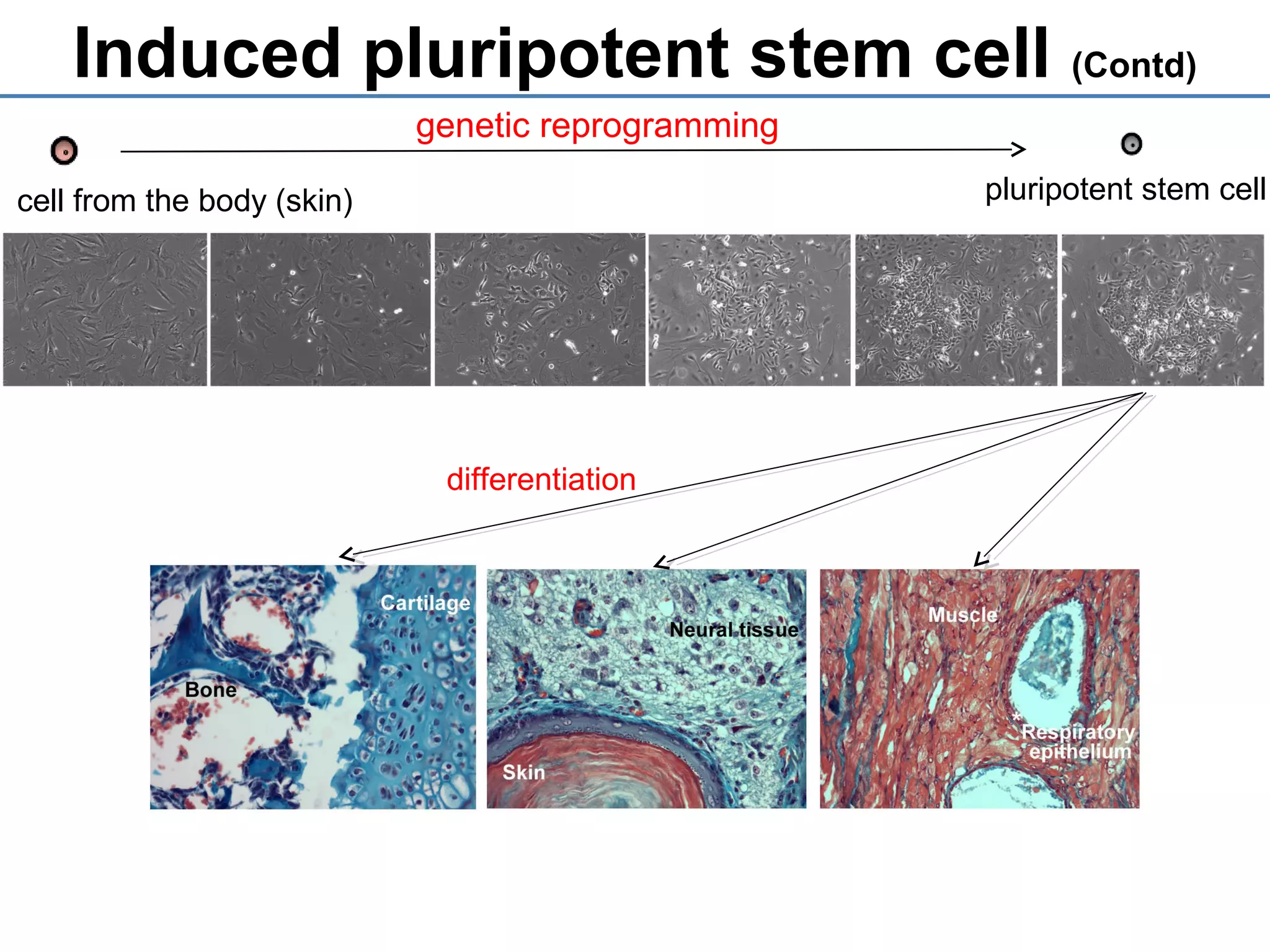 Induced pluripotent stem cell (Contd)
cell from the body (skin)
genetic reprogramming
pluripotent stem cell
differentiation
 