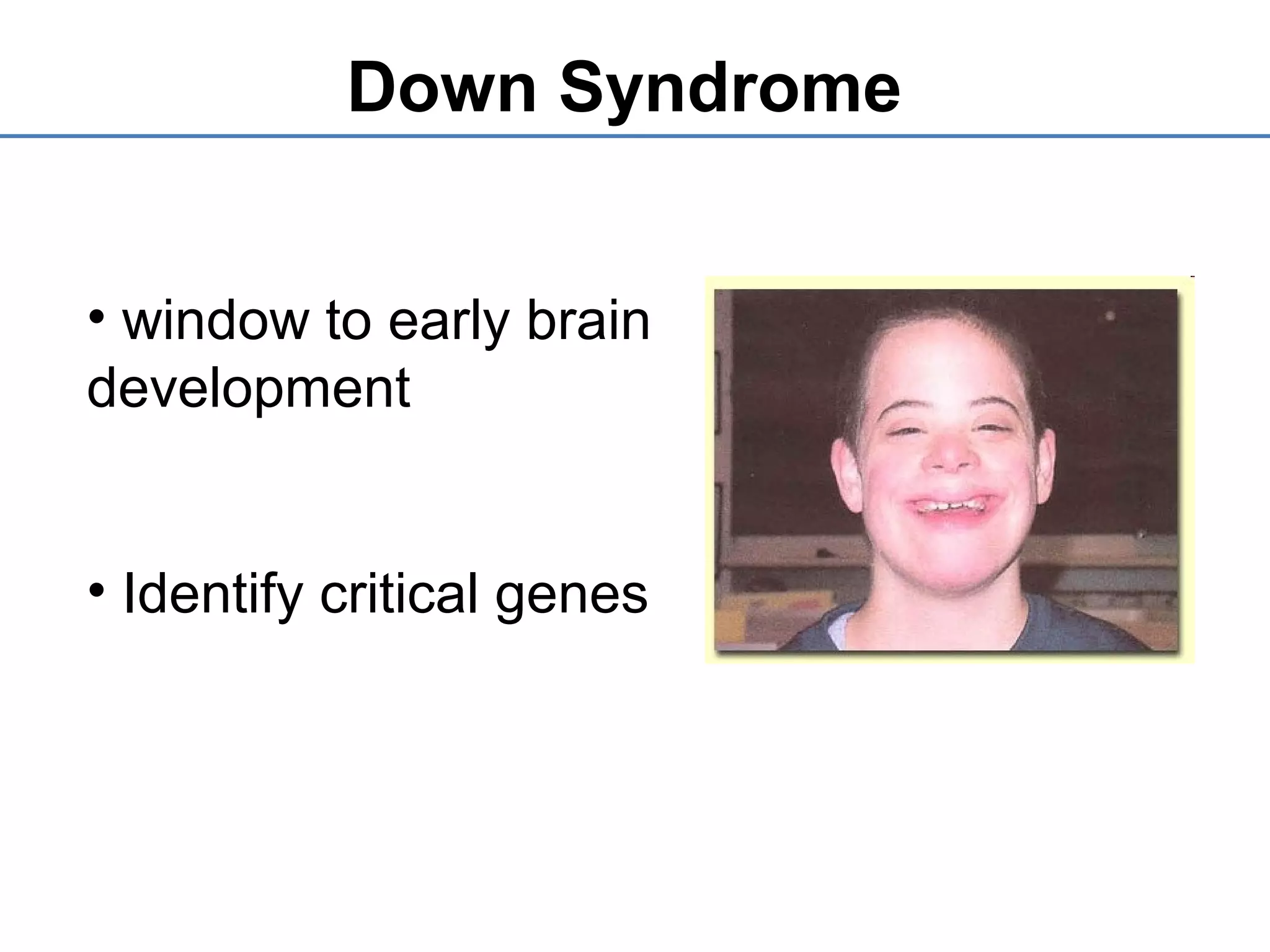 • window to early brain
development
• Identify critical genes
Down Syndrome
 