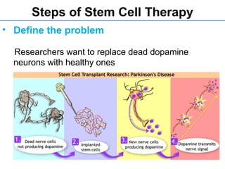 Steps of Stem Cell Therapy
• Define the problem
Researchers want to replace dead dopamine
neurons with healthy ones
 