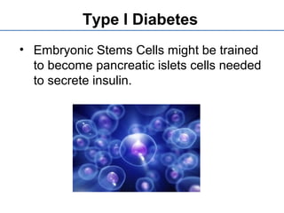 Type I Diabetes
• Embryonic Stems Cells might be trained
to become pancreatic islets cells needed
to secrete insulin.
 