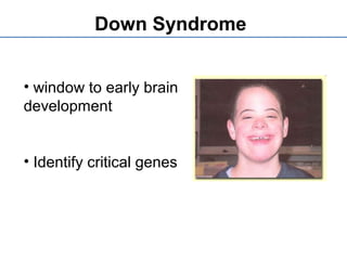 • window to early brain
development
• Identify critical genes
Down Syndrome
 