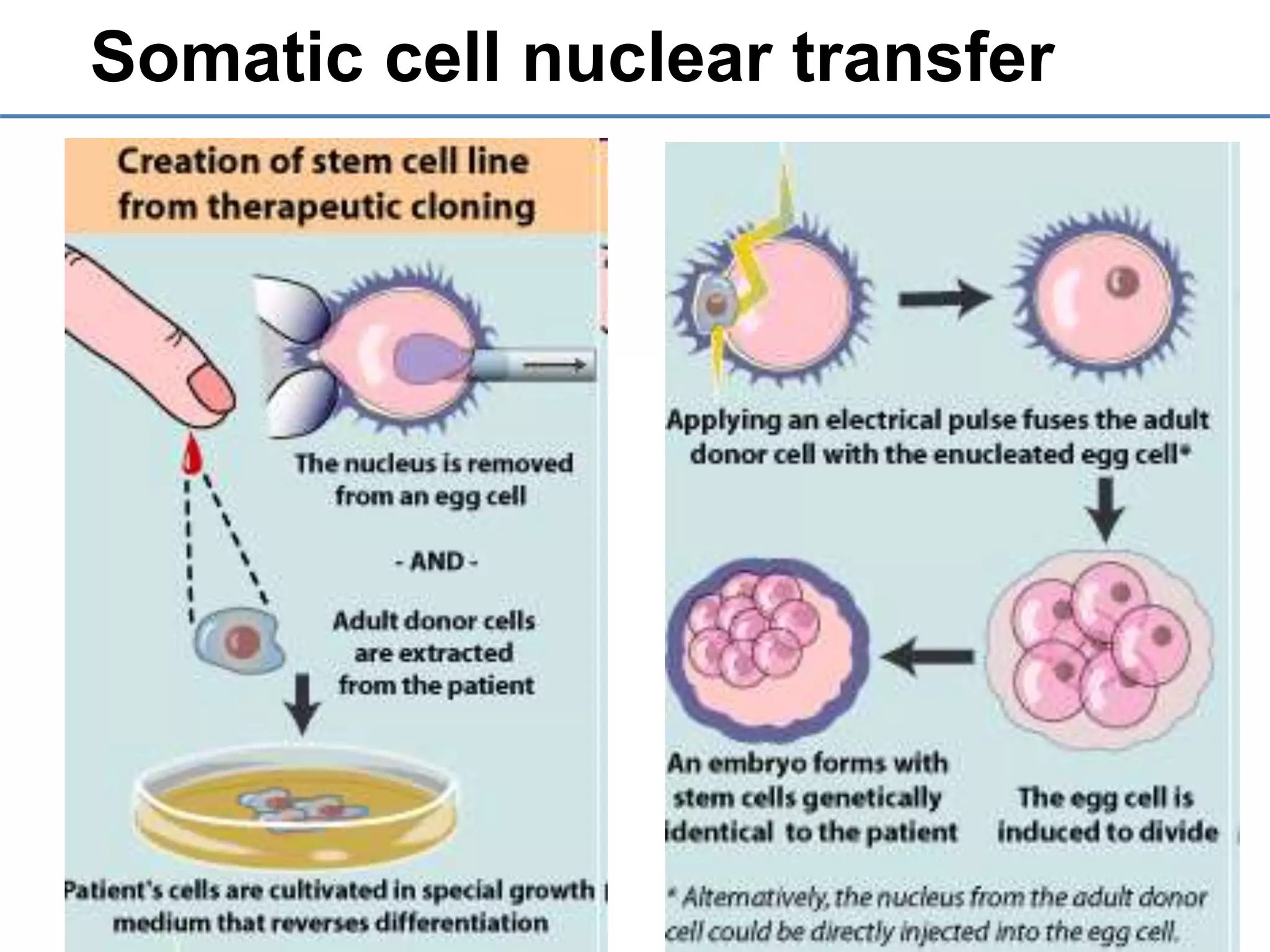 Somatic cell nuclear transfer
 