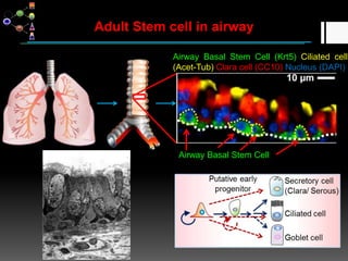 Stem cell and regenerative medicine | PPTX