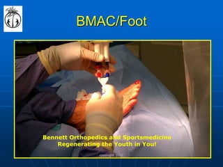 Stem Cell Case Study By Dr. Bennett | PDF