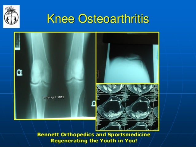 Stem cell failure stories image