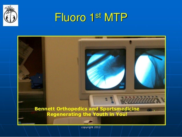 Stem cells trials picture