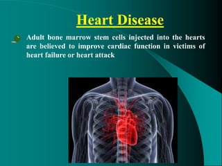 Heart Disease
• Adult bone marrow stem cells injected into the hearts
are believed to improve cardiac function in victims of
heart failure or heart attack
 
