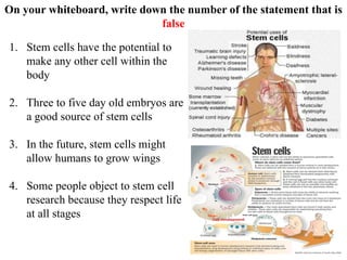 On your whiteboard, write down the number of the statement that is
false
1. Stem cells have the potential to
make any other cell within the
body
2. Three to five day old embryos are
a good source of stem cells
3. In the future, stem cells might
allow humans to grow wings
4. Some people object to stem cell
research because they respect life
at all stages
 