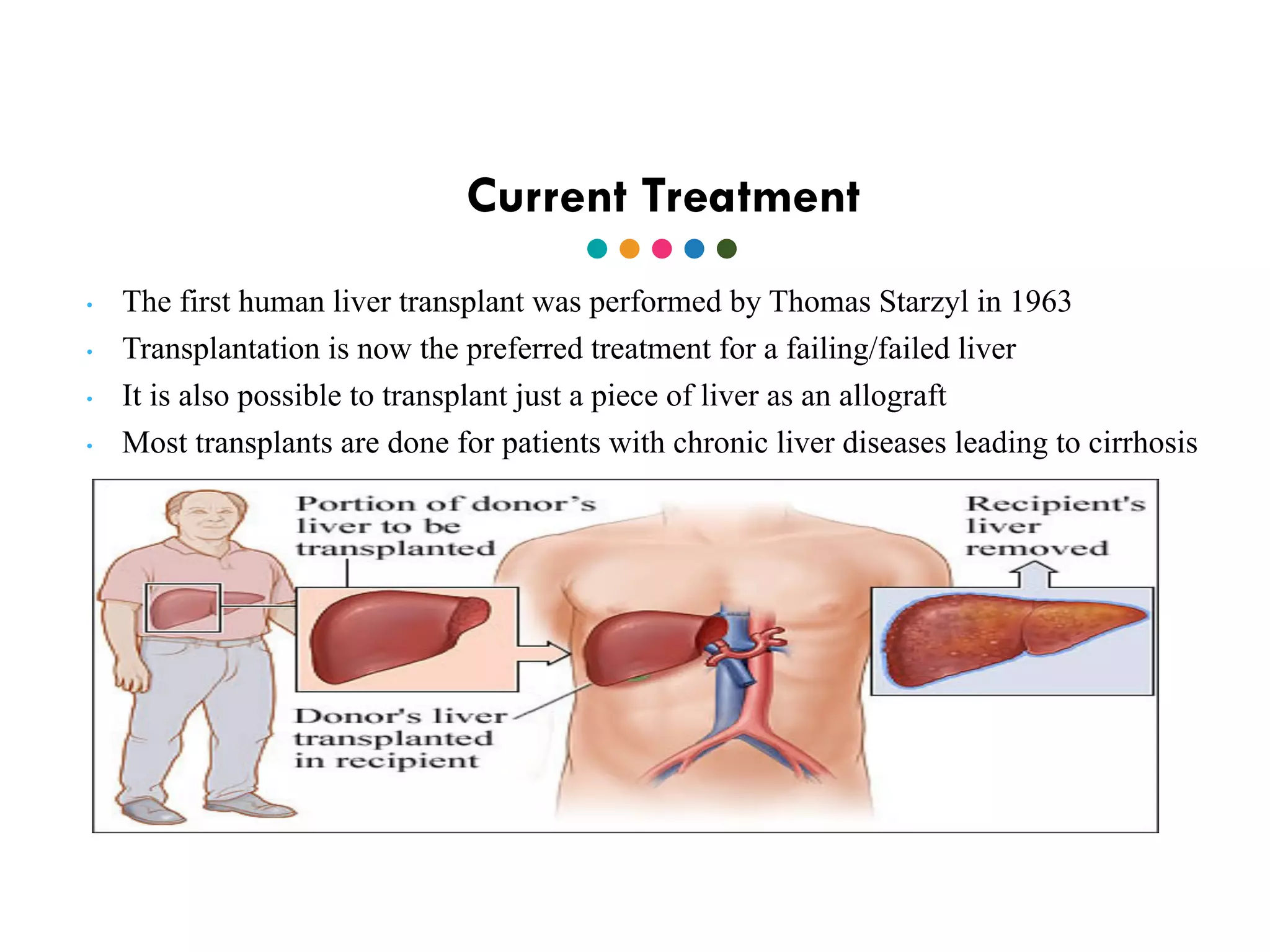 Current Treatment
• The first human liver transplant was performed by Thomas Starzyl in 1963
• Transplantation is now the preferred treatment for a failing/failed liver
• It is also possible to transplant just a piece of liver as an allograft
• Most transplants are done for patients with chronic liver diseases leading to cirrhosis
 