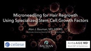 Microneedling for Hair Regrowth  
Using Specialized Stem Cell Growth Factors
Alan J. Bauman, MD, ABHRS
Diplomate, American Board of Hair Restoration Surgery
11.19.2019 - Boca Raton, FL
 