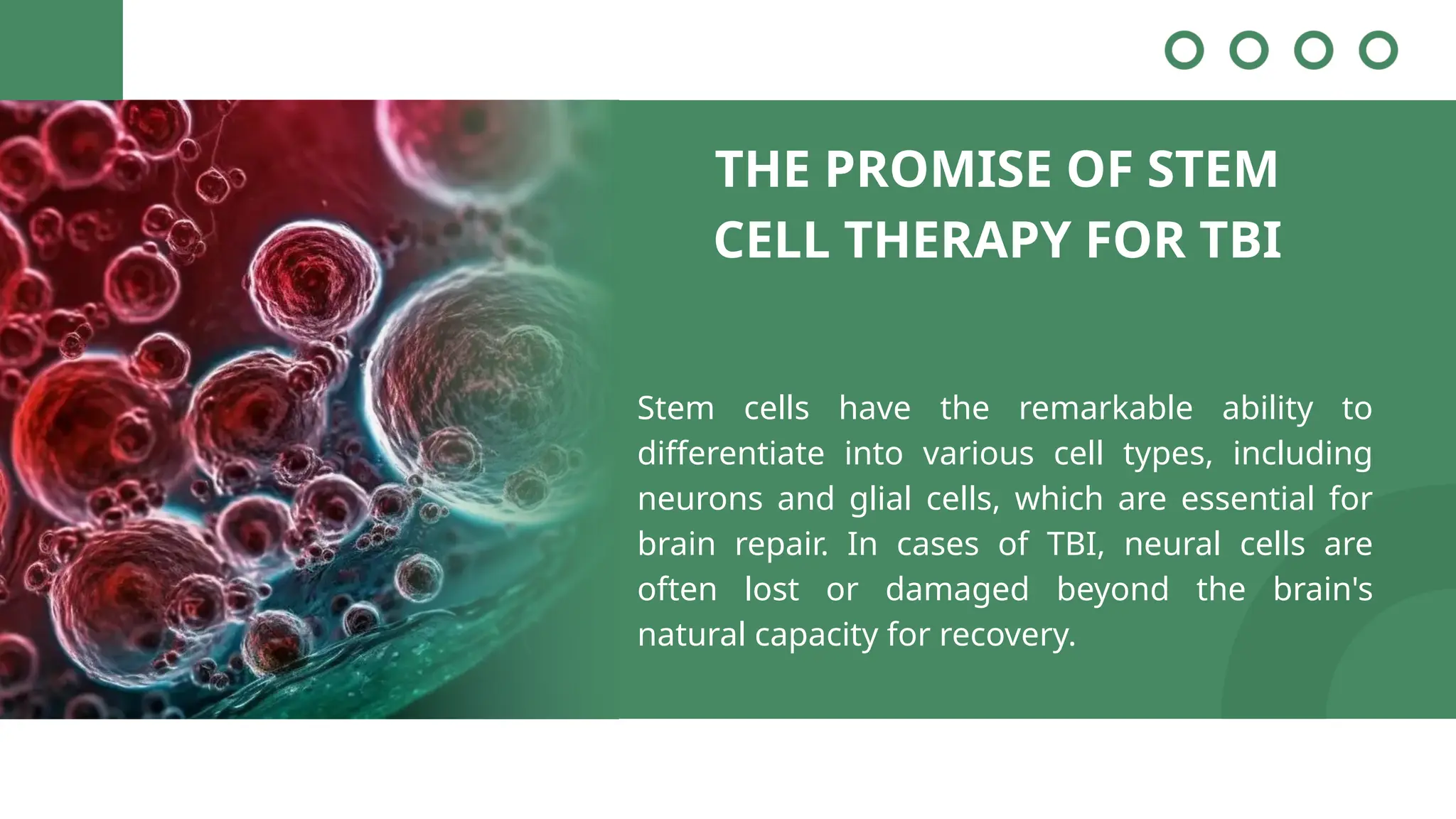 THE PROMISE OF STEM
CELL THERAPY FOR TBI
Stem cells have the remarkable ability to
differentiate into various cell types, including
neurons and glial cells, which are essential for
brain repair. In cases of TBI, neural cells are
often lost or damaged beyond the brain's
natural capacity for recovery.