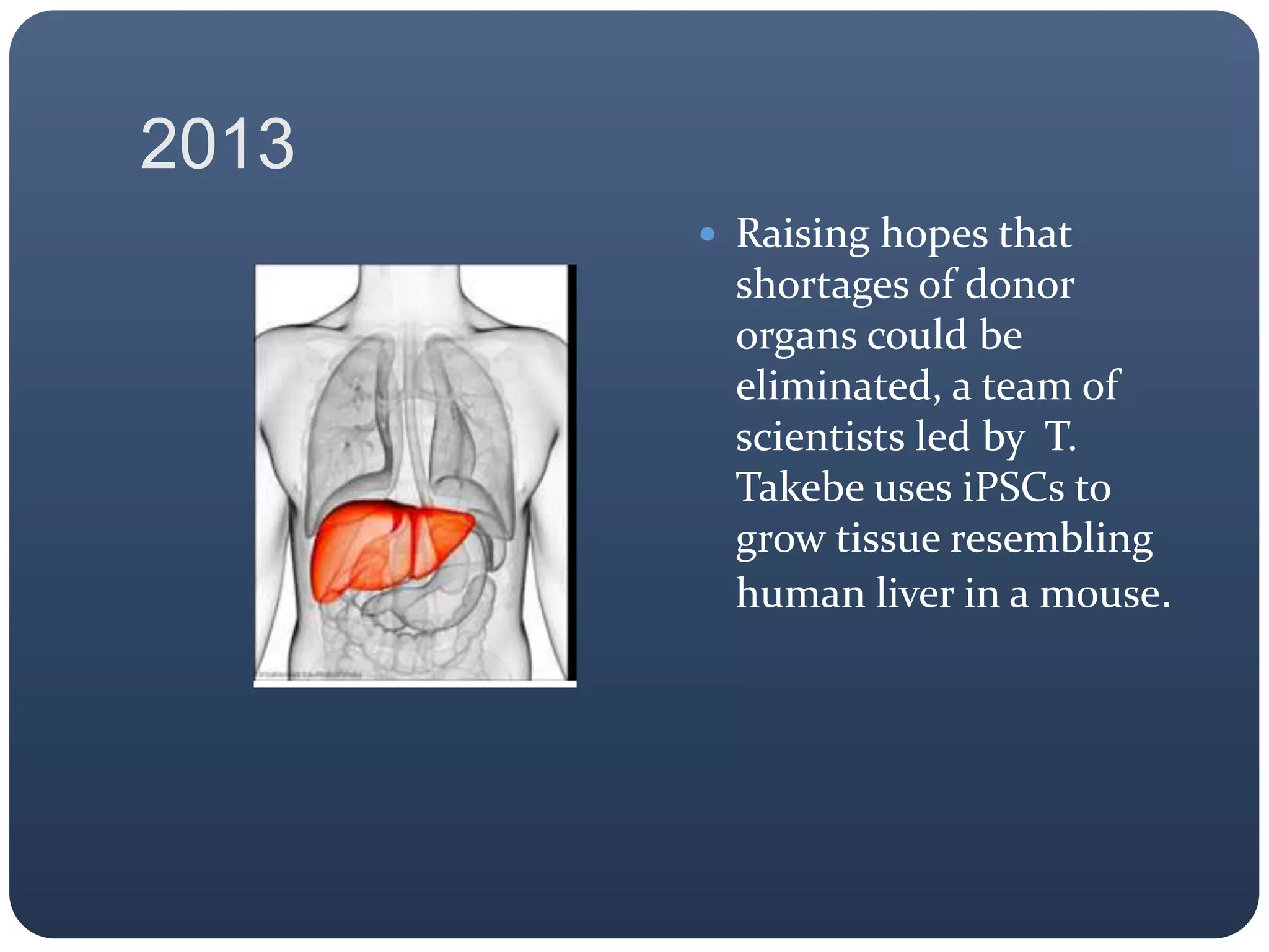 2013
 Raising hopes that
shortages of donor
organs could be
eliminated, a team of
scientists led by T.
Takebe uses iPSCs to
grow tissue resembling
human liver in a mouse.
 