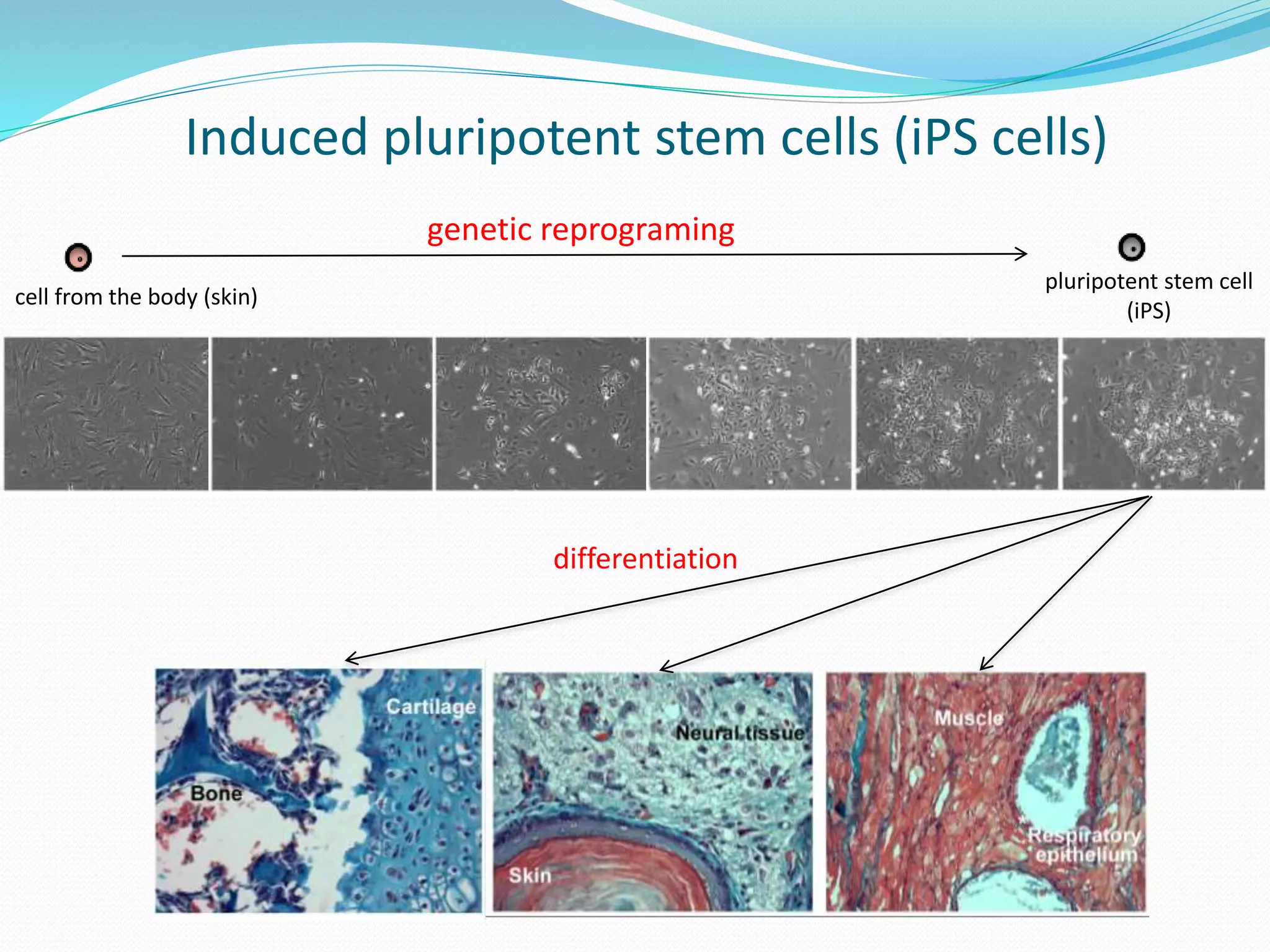 Induced pluripotent stem cells (iPS cells)
cell from the body (skin)
genetic reprograming
pluripotent stem cell
(iPS)
differentiation
 