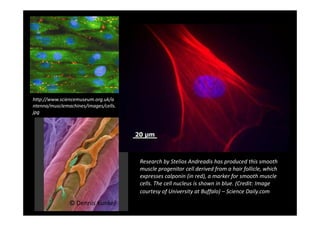 http://www.sciencemuseum.org.uk/a
ntenna/musclemachines/images/cells.
jpg
© Dennis Kunkel
Research by Stelios Andreadis has produced this smooth
muscle progenitor cell derived from a hair follicle, which
expresses calponin (in red), a marker for smooth muscle
cells. The cell nucleus is shown in blue. (Credit: Image
courtesy of University at Buffalo) – Science Daily.com)
 