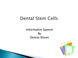 Informative Speech
By
Denise Resen
 