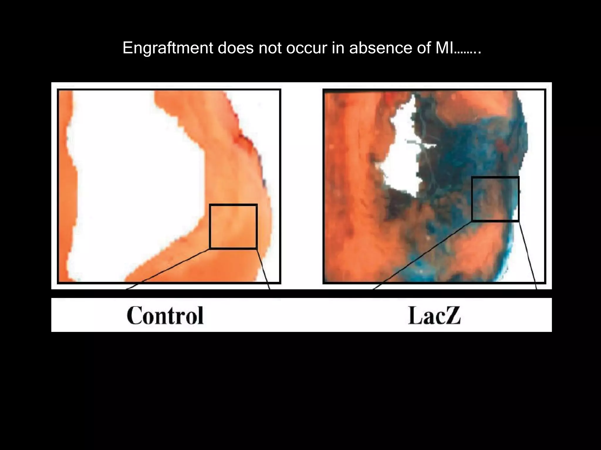 Engraftment does not occur in absence of MI…….. 