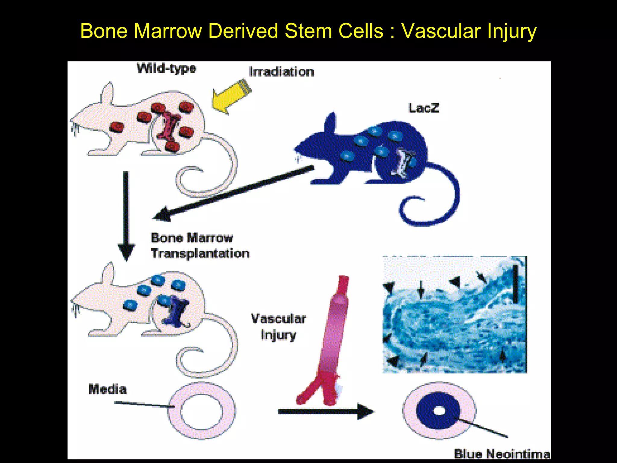 Bone Marrow Derived Stem Cells : Vascular Injury 