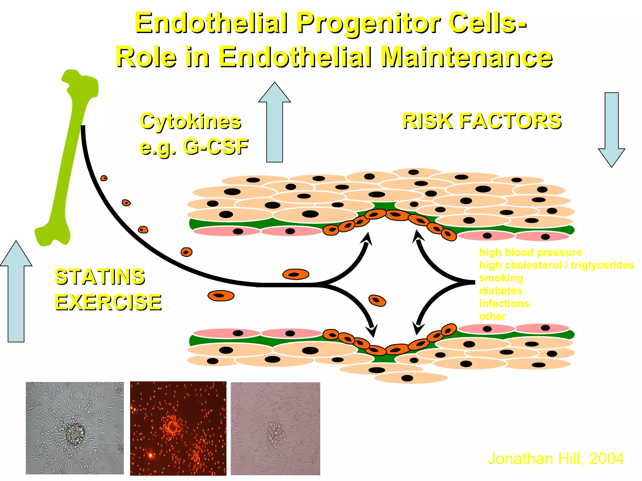 Endothelial Progenitor Cells-  Role in Endothelial Maintenance Jonathan Hill, 2004 high blood pressure high cholesterol / triglycerides smoking diabetes infections other RISK FACTORS Cytokines e.g. G-CSF STATINS EXERCISE 