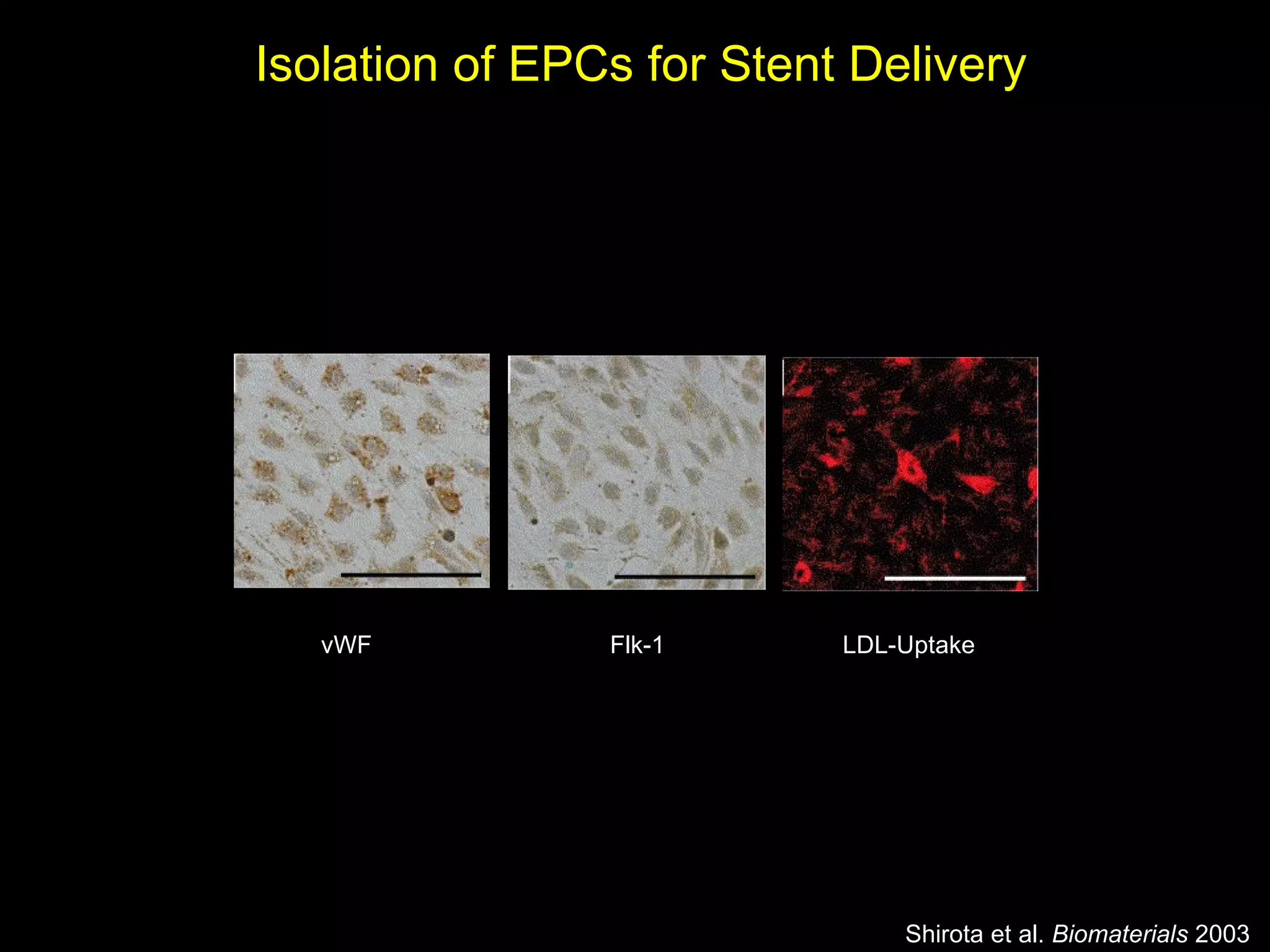 Shirota et al.  Biomaterials  2003 vWF Flk-1 LDL-Uptake Isolation of EPCs for Stent Delivery 