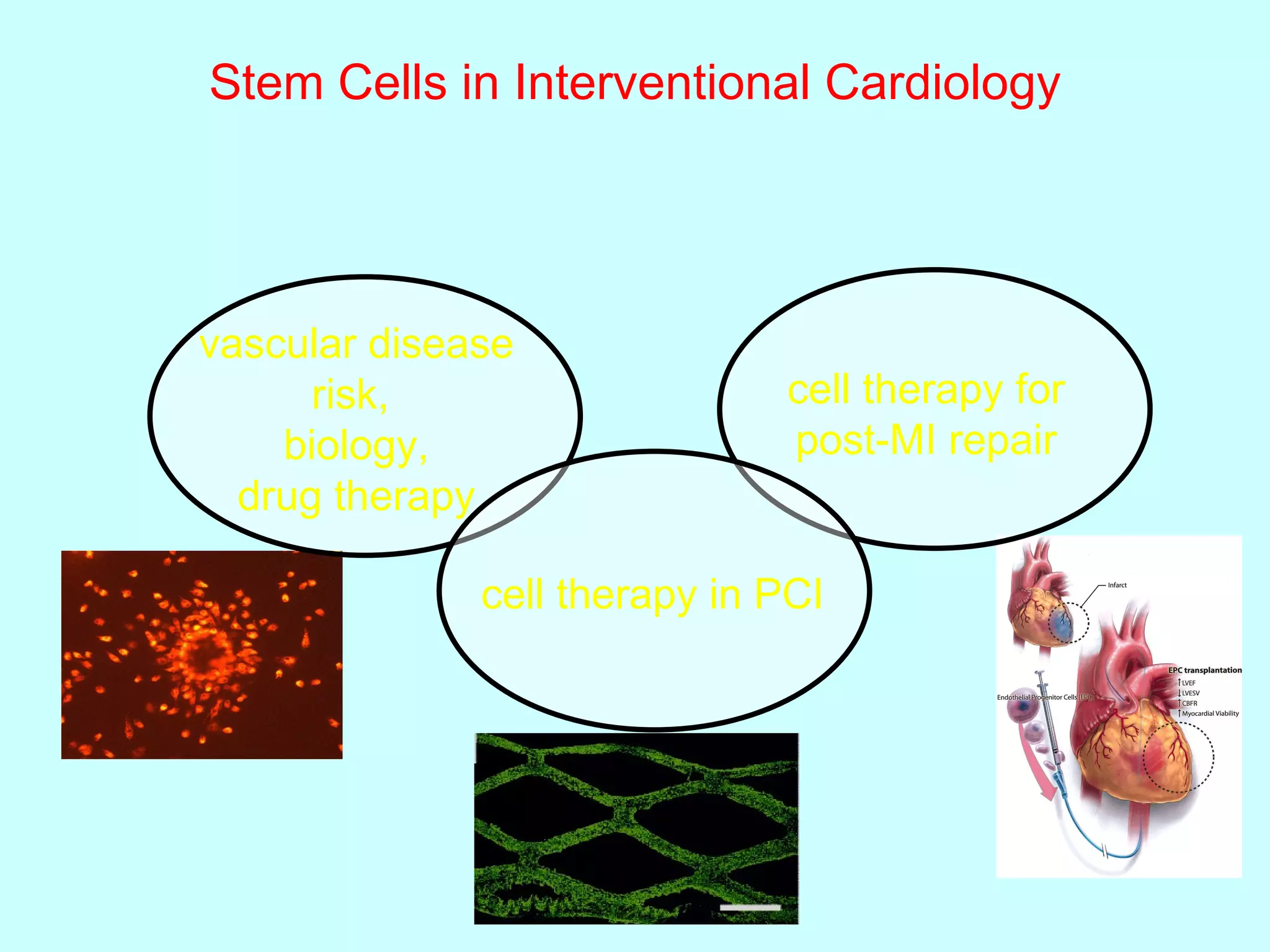 Stem Cells in Interventional Cardiology vascular disease risk,  biology, drug therapy cell therapy for post-MI repair cell therapy in PCI 