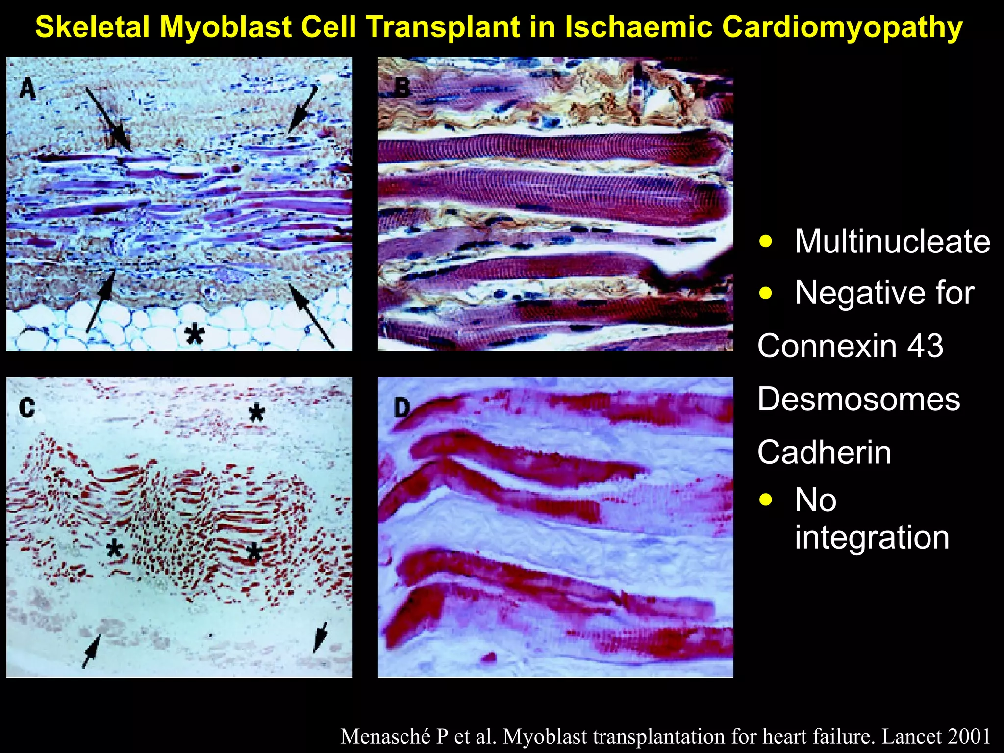 Multinucleate Negative for Connexin  43 D esmosomes C adherin No integration Skeletal Myoblast Cell Transplant in Ischaemic Cardiomyopathy  Menasché P   et al. Myoblast transplantation   for heart failure. Lancet 2001 