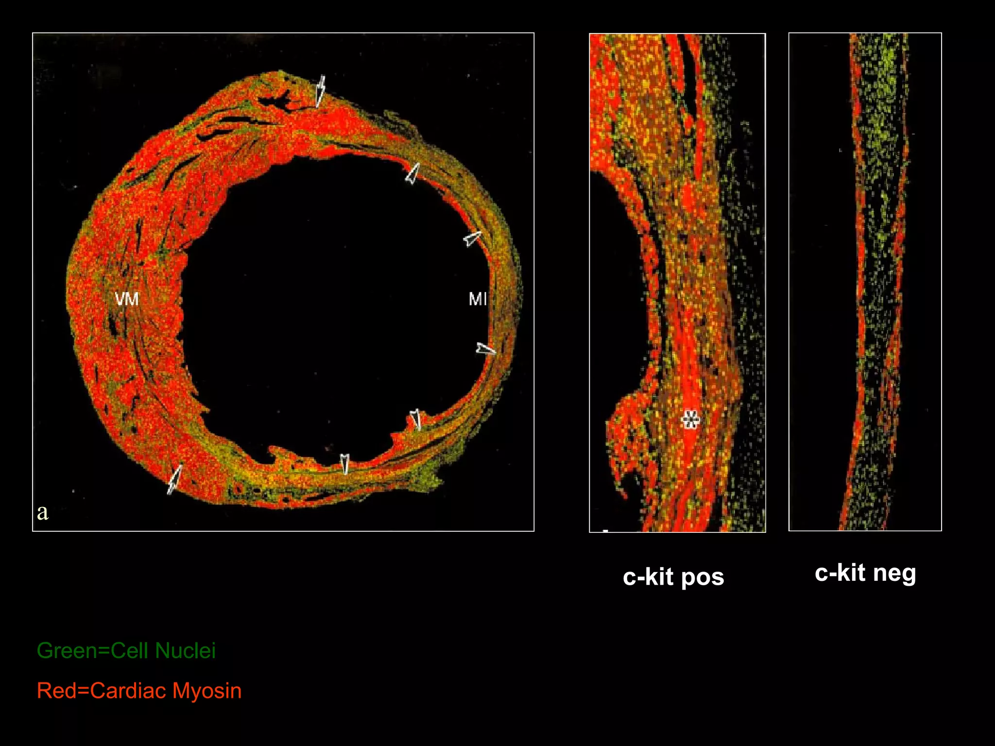 Red=Cardiac Myosin a Green=Cell Nuclei c-kit neg c-kit pos 
