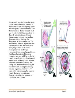 Stem cells by Islam Osman Page 8
A few small studies have also been
carried out in humans, usually in
patients who are undergoing open-
heart surgery. Several of these have
demonstrated that stem cells that
are injected into the circulation or
directly into the injured heart
tissue appear to improve cardiac
function and/or induce the
formation of new capillaries. The
mechanism for this repair remains
controversial, and the stem cells
likely regenerate heart tissue
through several pathways.
However, the stem cell populations
that have been tested in these
experiments vary widely, as do the
conditions of their purification and
application. Although much more
research is needed to assess the
safety and improve the efficacy of
this approach, these preliminary
clinical experiments show how
stem cells may one day be used to
repair damaged heart tissue,
thereby reducing the burden of
cardiovascular disease.
 