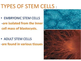 TYPES OF STEM CELLS :
• EMBRYONIC STEM CELLS
-
• ADULT STEM CELLS
-
 