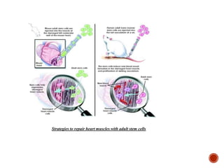 Strategies to repair heart muscles with adult stem cells
 