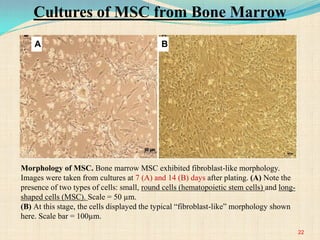Morphology of MSC. Bone marrow MSC exhibited fibroblast-like morphology.
Images were taken from cultures at 7 (A) and 14 (B) days after plating. (A) Note the
presence of two types of cells: small, round cells (hematopoietic stem cells) and long-
shaped cells (MSC). Scale = 50 µm.
(B) At this stage, the cells displayed the typical “fibroblast-like” morphology shown
here. Scale bar = 100µm.
A B
22
Cultures of MSC from Bone Marrow
 