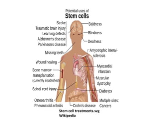 Stem cell treatments.svg
Wikipedia
 