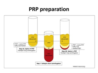 PRP preparation
 