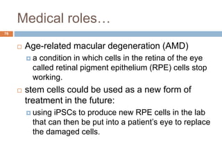 Medical roles…
76
 Age-related macular degeneration (AMD)
 a condition in which cells in the retina of the eye
called retinal pigment epithelium (RPE) cells stop
working.
 stem cells could be used as a new form of
treatment in the future:
 using iPSCs to produce new RPE cells in the lab
that can then be put into a patient’s eye to replace
the damaged cells.
 