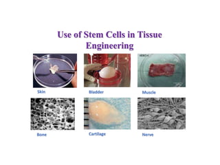 Skin Bladder Muscle
Bone Cartilage Nerve
Use of Stem Cells in Tissue
Engineering
 