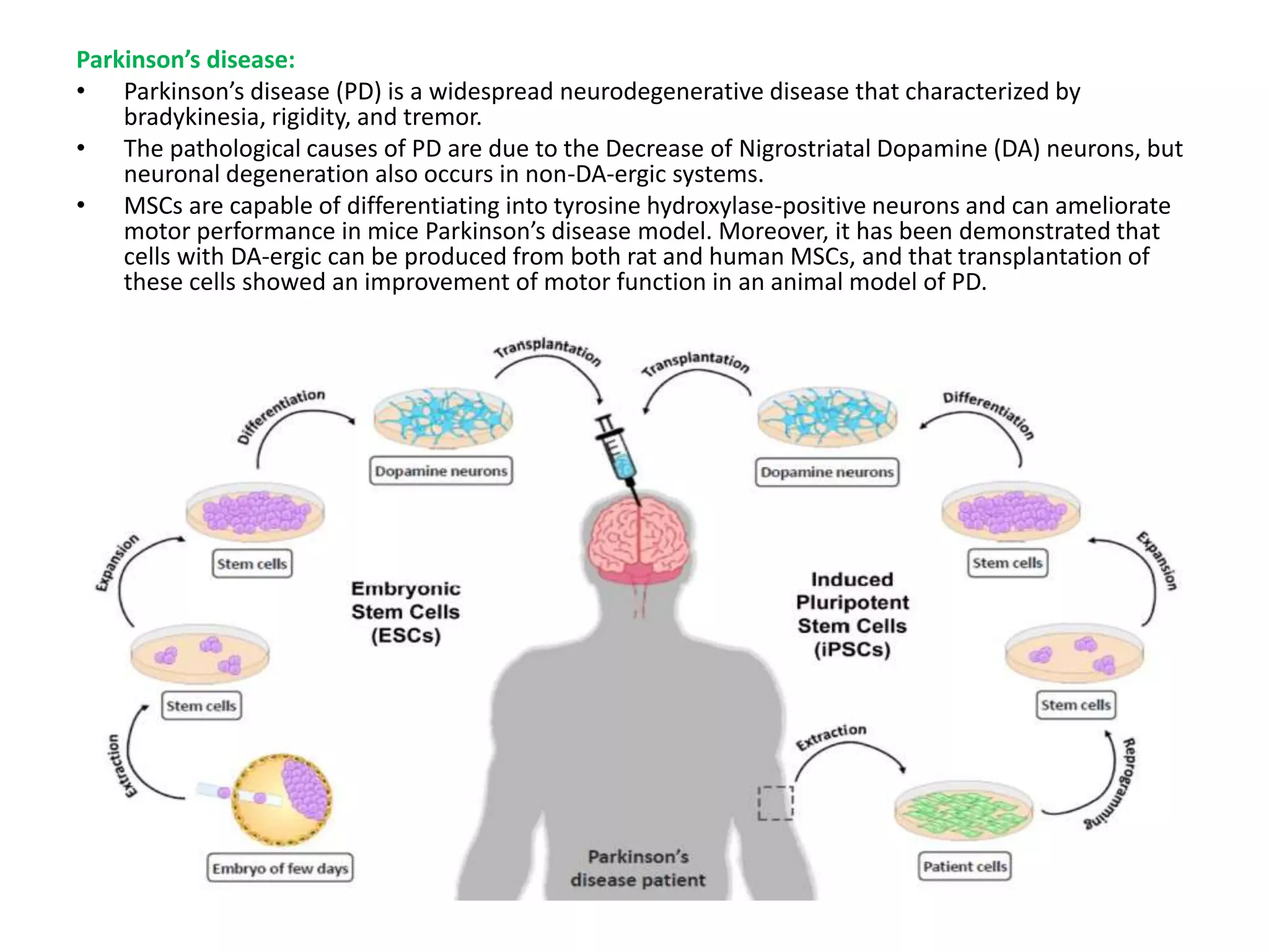 Parkinson’s disease:
• Parkinson’s disease (PD) is a widespread neurodegenerative disease that characterized by
bradykinesia, rigidity, and tremor.
• The pathological causes of PD are due to the Decrease of Nigrostriatal Dopamine (DA) neurons, but
neuronal degeneration also occurs in non-DA-ergic systems.
• MSCs are capable of differentiating into tyrosine hydroxylase-positive neurons and can ameliorate
motor performance in mice Parkinson’s disease model. Moreover, it has been demonstrated that
cells with DA-ergic can be produced from both rat and human MSCs, and that transplantation of
these cells showed an improvement of motor function in an animal model of PD.
 