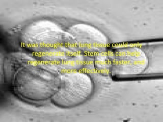 It was thought that lung tissue could only regenerate itself. Stem cells can help regenerate lung tissue much faster, and more effectively.