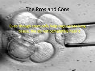 The Pros and Cons Even though stem cells help regenerate lung tissue, the do not completely heal it