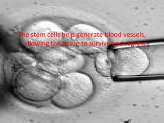The stem cells help generate blood vessels, allowing the tissue to survive and regrow