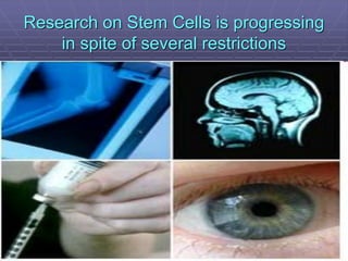 Research on Stem Cells is progressing
in spite of several restrictions
 