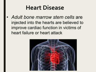 Heart Disease
• Adult bone marrow stem cells are
injected into the hearts are believed to
improve cardiac function in victims of
heart failure or heart attack
 