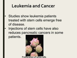 Leukemia and Cancer
• Studies show leukemia patients
treated with stem cells emerge free
of disease.
• Injections of stem cells have also
reduces pancreatic cancers in some
patients.
Proliferation of white cells
 