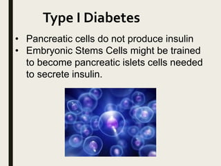 Type I Diabetes
• Pancreatic cells do not produce insulin
• Embryonic Stems Cells might be trained
to become pancreatic islets cells needed
to secrete insulin.
 