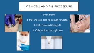 STEM CELL AND PRP PROCEDURE
1. Draw blood
2. PRP and stem cells go through harvesting
3. Cells reinfused through IV
4. Cells reinfused through nose
 