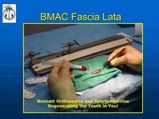 BMAC Fascia Lata 
Bennett Orthopedics and Sportsmedicine 
Regenerating the Youth in You! 
copyright 2012  